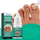 Nail Fungus Solution, Anti Infection Nail Fungus Removal Gel, Ingrown Toenail Treatment Nail Care Oil, Nail Fungus Treatments Serum