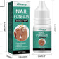 Nail Fungus Solution, Anti Infection Nail Fungus Removal Gel, Ingrown Toenail Treatment Nail Care Oil, Nail Fungus Treatments Serum